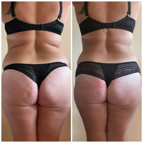 &