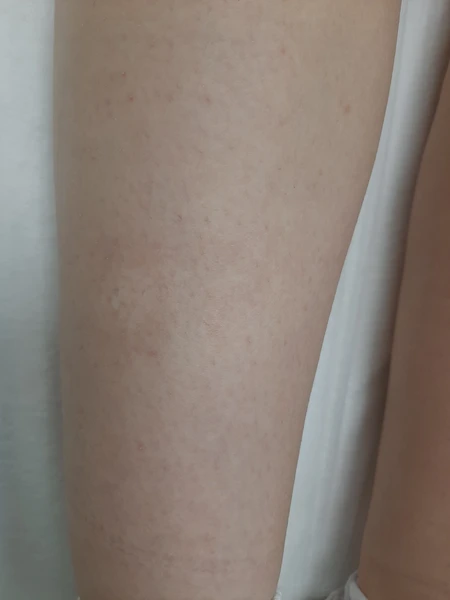&