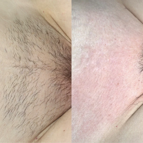 &