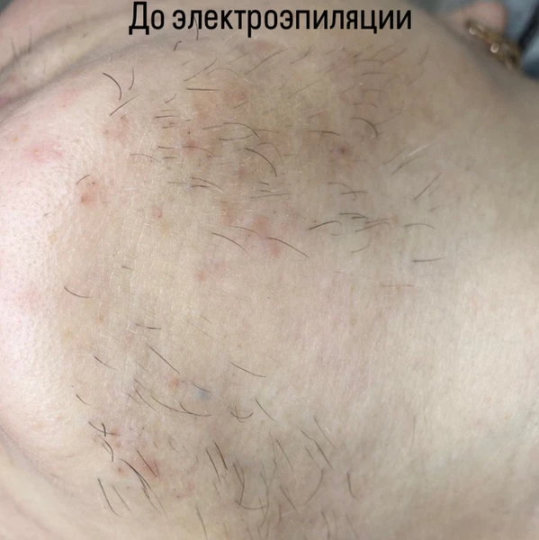 &