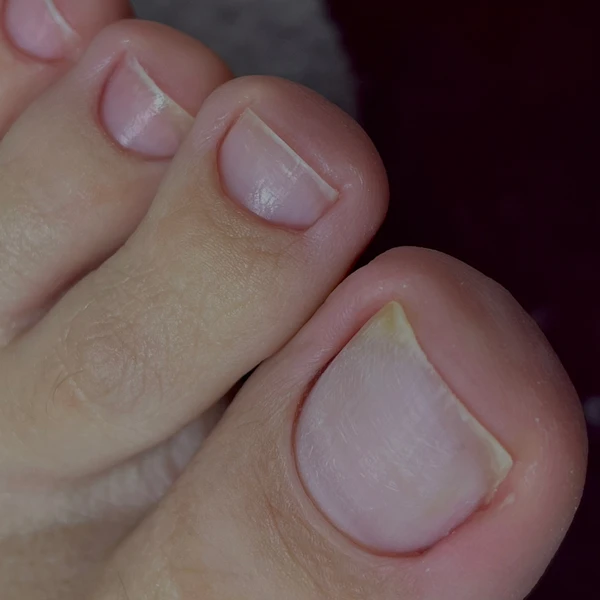 &