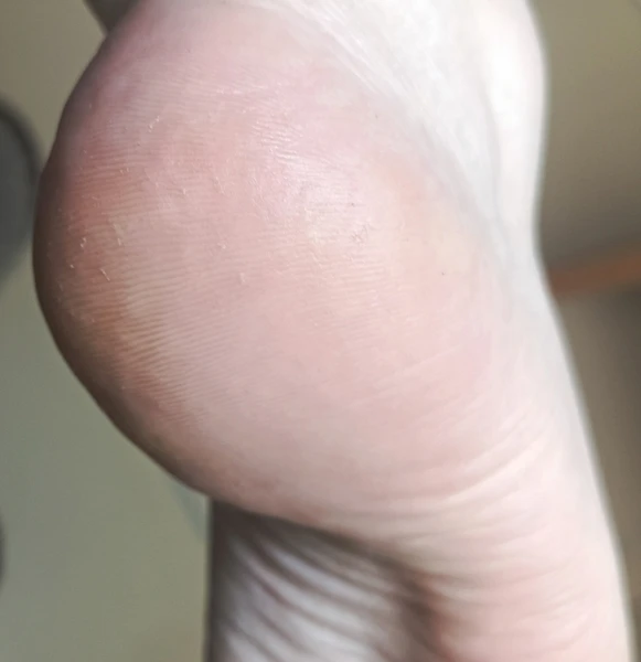 &