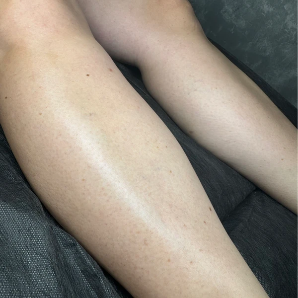 &
