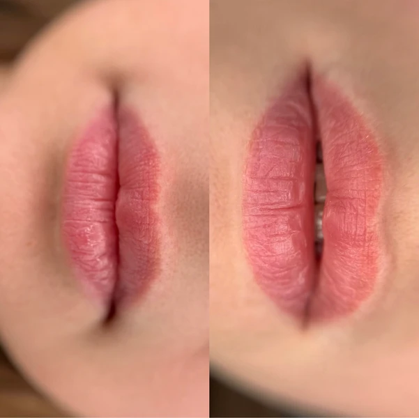 &