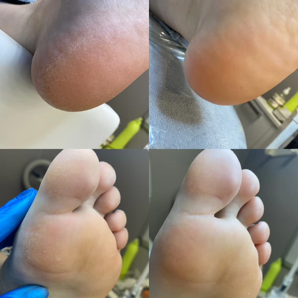 &