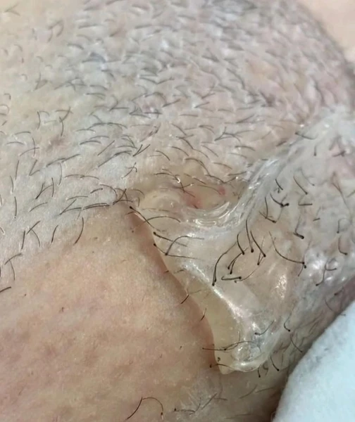 &
