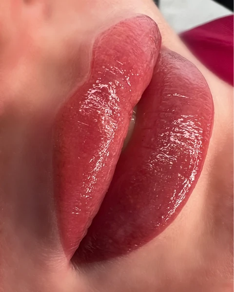 &