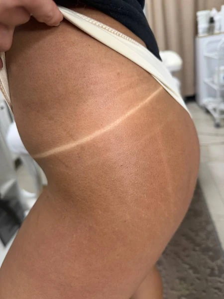 &