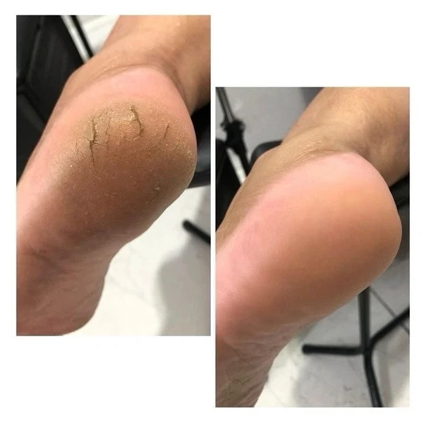 &