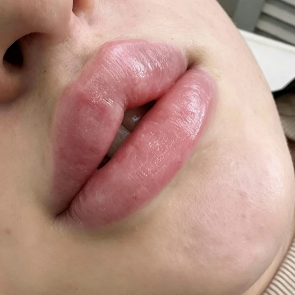 &