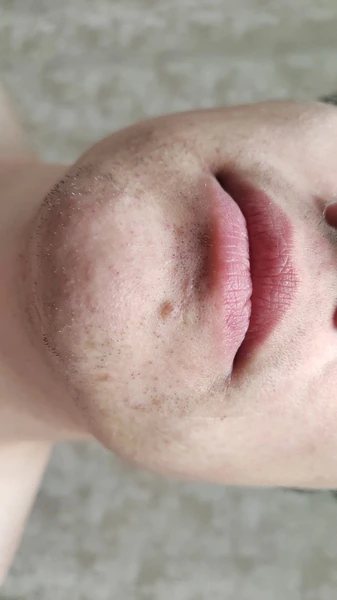 &