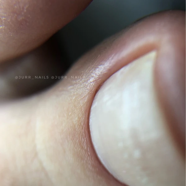 &