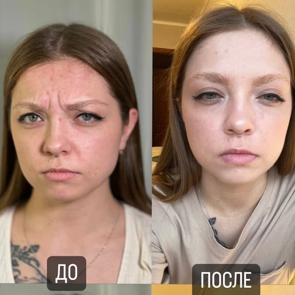 &