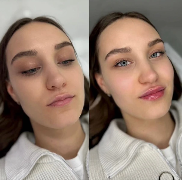 &