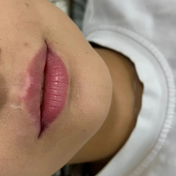 &
