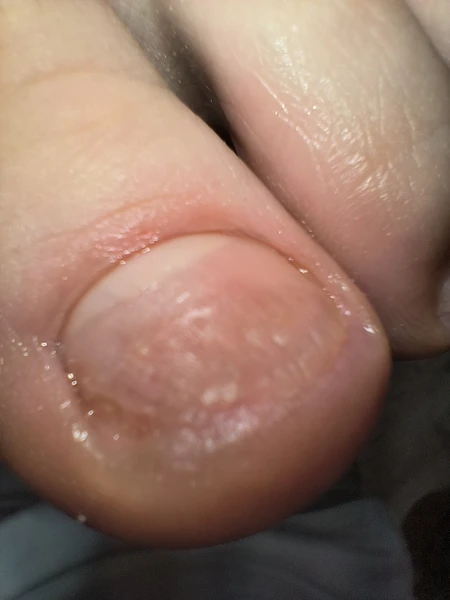 &