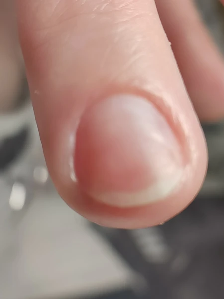 &
