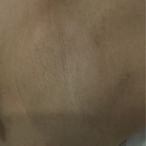 &