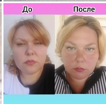 &