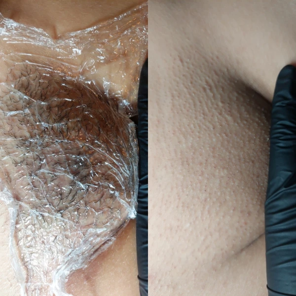 &