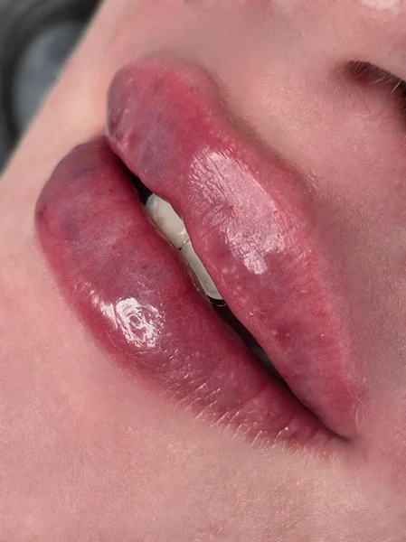 &