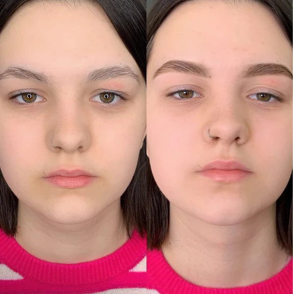 &