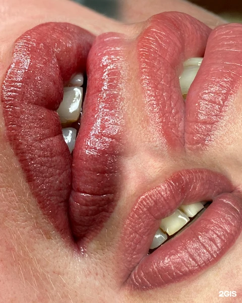 &