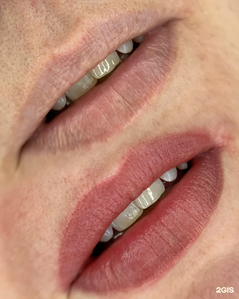 &