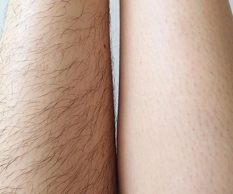 &