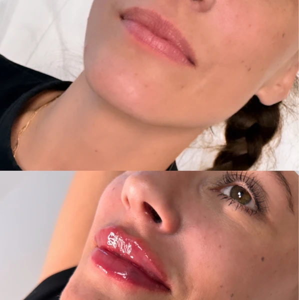 &