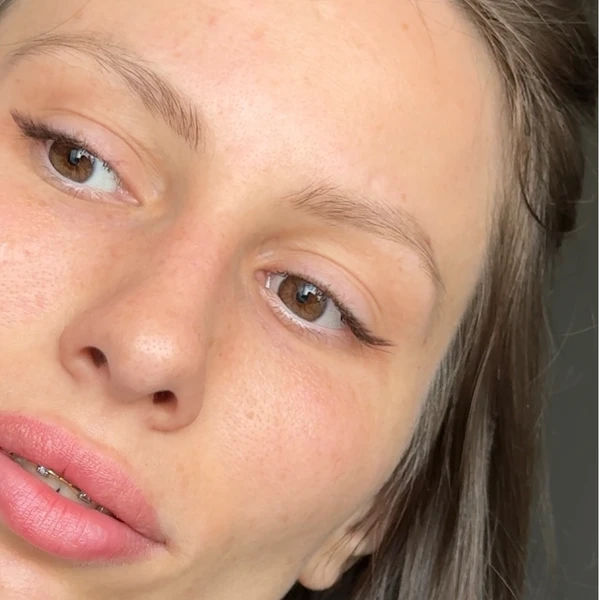 &