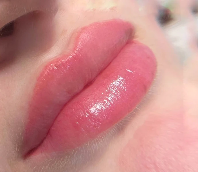 &