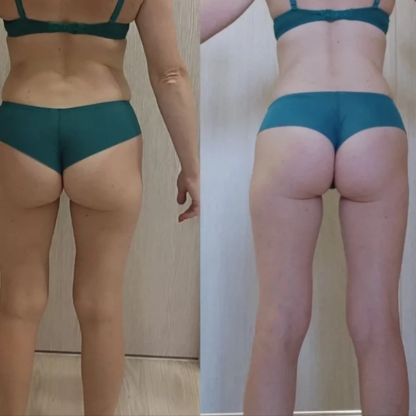 &