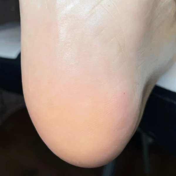 &