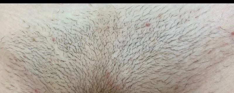 &