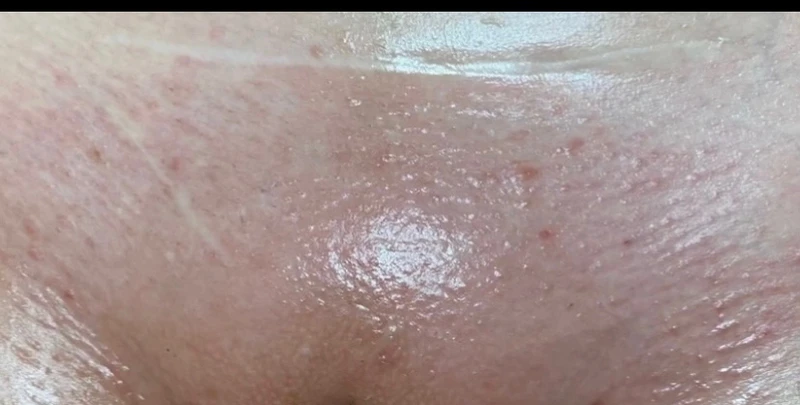 &