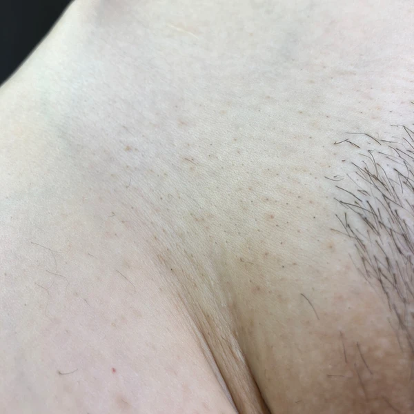 &