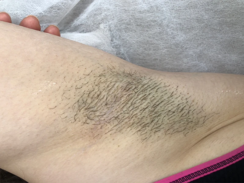 &