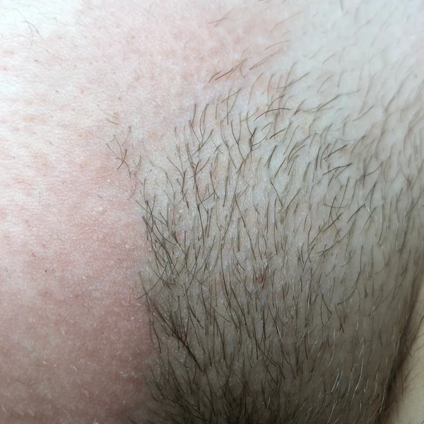 &