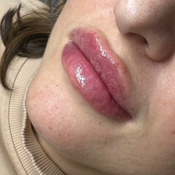 &