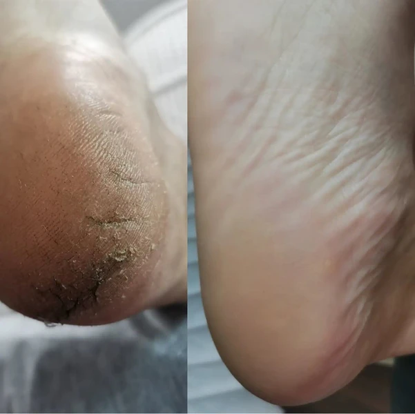 &