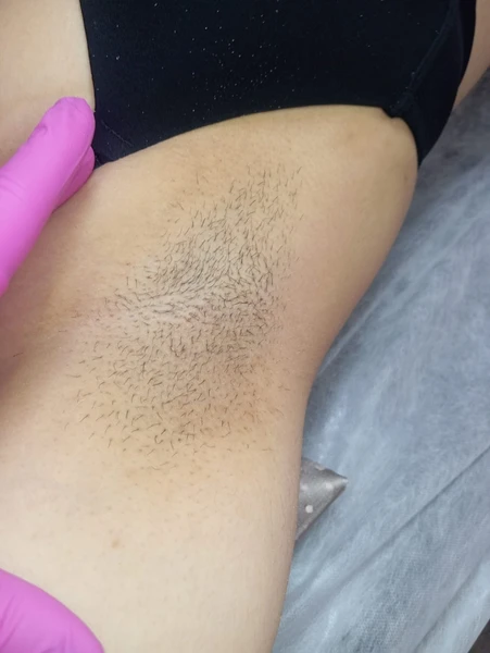 &