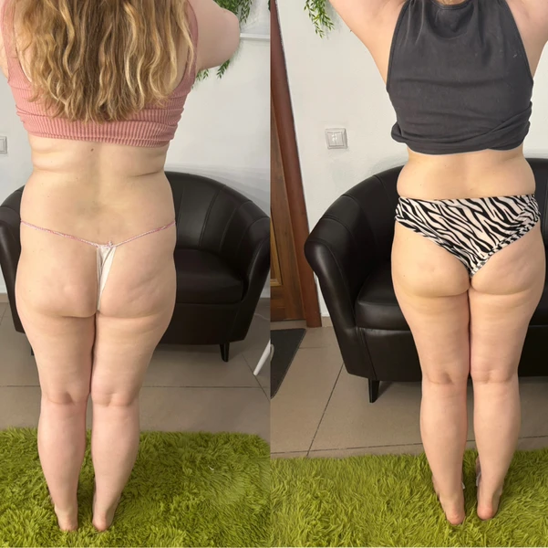 &