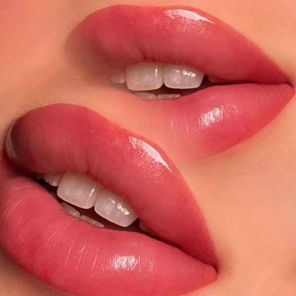 &