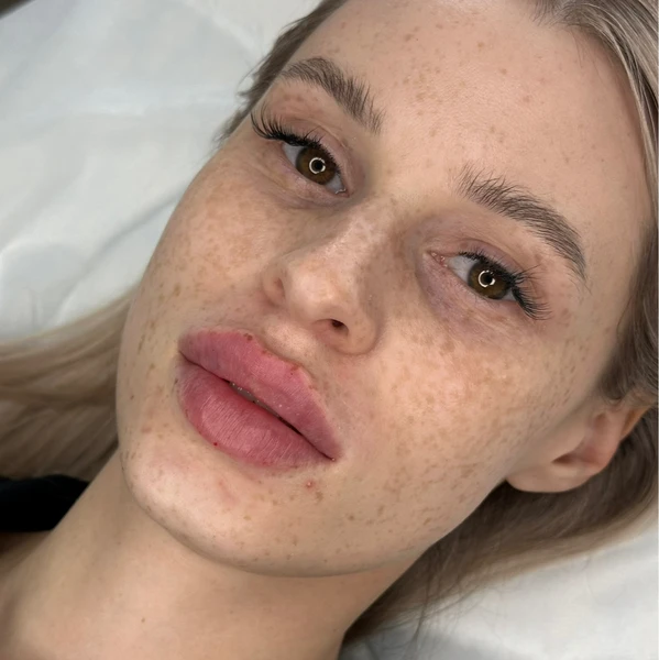 &