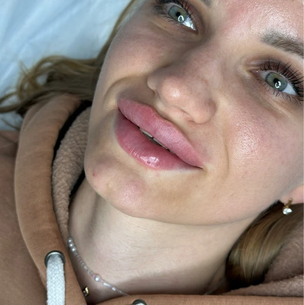 &