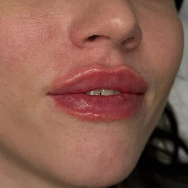 &