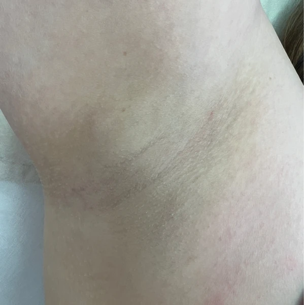 &