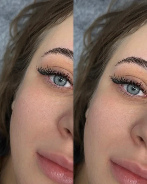 &