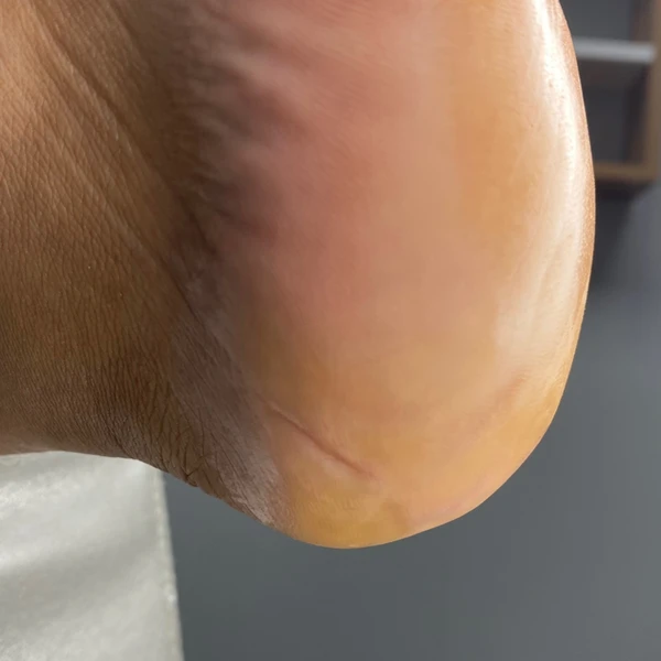 &